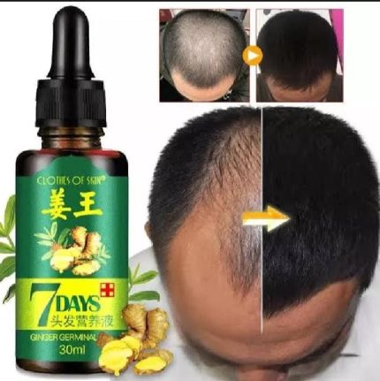 7 Day Ginger Germinal Oil Hair Nutrient for Hair Growth